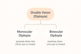 Image result for Diplopia