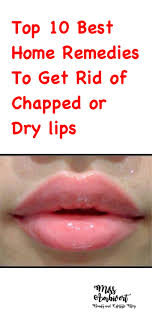 Chapped Lips Or Cracked Lips Is A Condition Developed Mainly Due To Dryness Some Of The Symptoms Are Scales Flak Dry Lips Remedy Dry Lips Chapped Lips Remedy