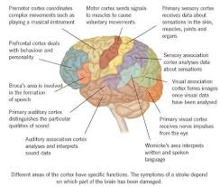 Stroke Brain Diagram Catalogue Of Schemas