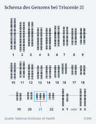 Maybe you would like to learn more about one of these? Pranataler Down Syndrom Test Der Befund Ist Erst Der Anfang Wissen Umwelt Dw 21 03 2021