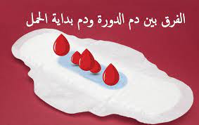 شكل دم الحمل بالصور