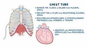 Image result for Chest Tube