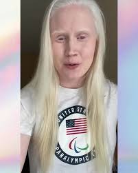 #Albinism did not stop @coroyo from becoming a three-time  #ParaOlympic#UnitedStates athlete. #inclusion4equality