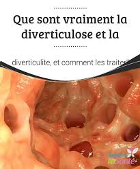Epingle Sur Remedes Naturels
