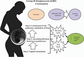 Image result for Group B Streptococcus
