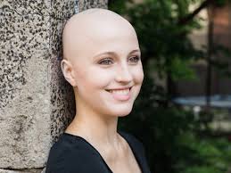 Alopecia areata is one type of hair loss that typically causes patches of baldness. Leben Mit Haarausfall Die Glatze Hat Mich Auch Zu Dem Menschen Gemacht Der Ich Jetzt Bin Edition F