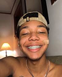 Ig Gibdiculous Cute Braces Braces Girls Cute Braces Colors