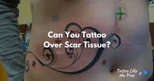 While many scars can be tattooed over with great success, there may be some challenges. Can You Tattoo Over Scars When You Can And Why You Should