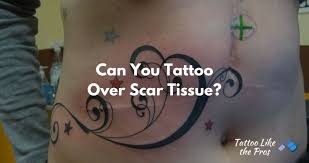 Complete healing can take over a year for deeper scars. Can You Tattoo Over Scars When You Can And Why You Should