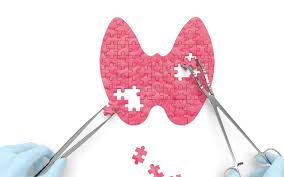 Ya sea que usted o un ser querido tenga cáncer de tiroides, saber lo que se puede esperar podrá ser de ayuda para sobrellevar mejor la situación. Tratamiento Del Cancer De Tiroides Aecc
