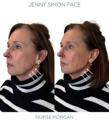 JennysimonFACE