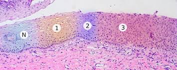 Check spelling or type a new query. General Oncology Knowledge Amboss