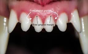 Why did these terrifying beasts evolve their nasty canines? The Abcs Of Veterinary Dentistry G Is For Gingiva