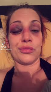 @FergusonBeccy's video Tweet