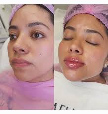 Safi Miran Rejuvenation Center Denver