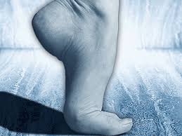 They can look like warts or sometimes a melanoma. Soles Of The Feet Should Also Be Checked For Skin Cancer