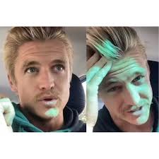 Balding Man Regains Shiny Hair After he Gave up Shampooing