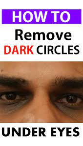 How To Reduce Dark Circles Naturally A Fit Life Style Dark Circles Around Eyes Remove Dark Circles Dark Circles Under Eyes