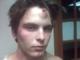 College student alleges police subjected him to 'vicious and brutal  beating' (video)