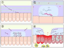 En finir avec le mal d'estomac, l'acidité gastrique, brûlures, helicobacter, rgo, ulcère, gastrite, remontées acides etc.méthode naturelle: Helicobacter Pylori Wikipedia