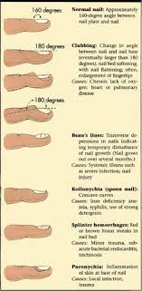 Chronic Kidney Disease Evolve Case Study