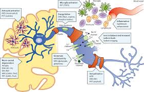The selection pressure will cause greater convergence in mutations that affect the critical spike protein of the virus that is responsible for breaking through the mucosal surfaces of our airways, the route used by the virus to enter the human body. Multiple Sclerosis The Lancet