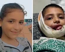 I feel constant pain': drug resistance adds to misery of Gaza gun victims