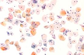 There are no simple and reliable ways to test for uterine cancer in women who do not have any signs or symptoms. Pap Smears The Best Tool In The Fight Against Cervical Cancer