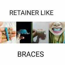 To finish off, or for a general clean, clean retainers by soaking them in special cleaning tablets (normally offered by your orthodontist) and lukewarm water, following the manufacturer's instructions. Fashion Retainer Like Brace Home Facebook