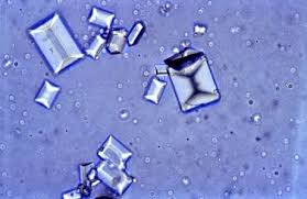 Struvite crystals in cats can form plugs that lodge in the urethra and lead to urinary obstruction. Cats With Struvite Crystals Posts Facebook