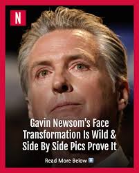 It's not just members of the MAGA-verse getting accused of plastic surgery.  There have also been noticeable changes in Governor Gavin Newsom's  appearance.