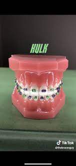 Avengers Braces Colors Braces Teeth Colors Dental Braces Colors