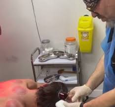 Select from premium brynne edelsten of the highest quality. Uk Love Island Star Jack Fincham Shares Bizarre Video Of Cupping Treatment Extracting Massive Clump Of Blood 7news Com Au