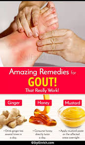 Pin On Gout
