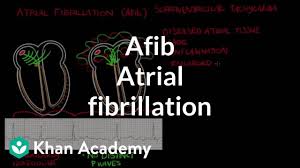 Atrial Fibrillation Afib Video Khan Academy