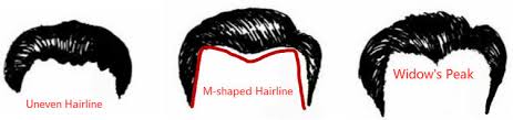 Forehead Face Reading Shapes Types Of Hairlines Lines