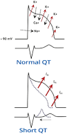 Image result for QT Interval