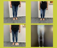 Image result for Functional Leg Length Discrepancy