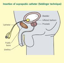 Image result for Bladder Antispasmodic