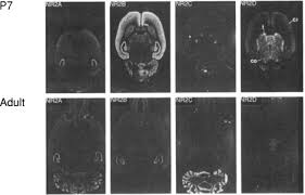 Postsynaptic nmdars can act as coincidence detectors for hebbian plasticity. The Nmda Receptor Channel Molecular Design Of A Coincidence Detector Sciencedirect