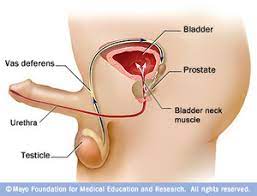 There is a version of the psa test that allows the doctor to measure a specific component, called the free psa. Prostate Cancer Symptoms Benefits Of Early Diagnosis