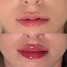 Kosmetologia Estetyczna