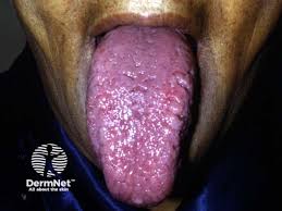 Image result for Isoglossa namuliensis