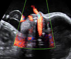 How long is 26 work weeks? You Are 26 Weeks And 2 Days Pregnant Familyeducation