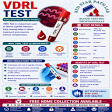 VDRL TEST product image