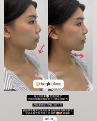 FAC£ cadaveric anatomy masterclass with the highly esteemed Korean leading  experts