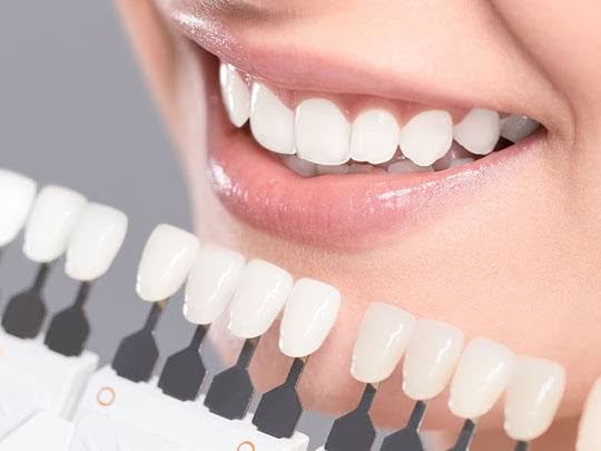 Dental Crown product image