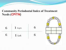 Development of the world health organization (who) community periodontal index of treatment needs (cpitn). Community Dentistry Ppt Video Online Download