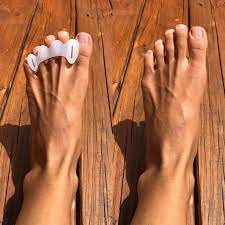 How long until yoga toes work. Correct Toes Review Are They Worth It Anya S Reviews