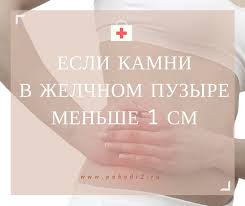 как избавиться от камней в желчном пузыре народными методами Prochitajte O Tom Kak Rastvorit I Vyvesti Kamni Zhelchnogo Puzyrya Naturalnymi Sredstvami Ziflan Eksportnaya Formula I Fitosbor Fitokalkule Budut Proyavlyat To Con Imagenes